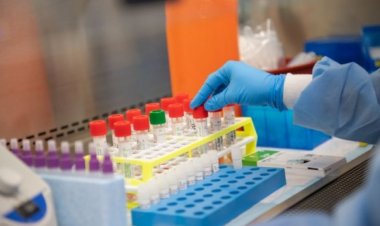 Coronavirus, in Italia in arrivo kit per test rapidi in 20 minuti