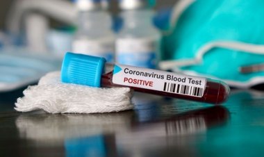 Coronavirus, Regione avvia test sul sangue per trovare positivi