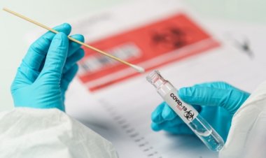 Coronavirus in Italia, calano ancora i contagi