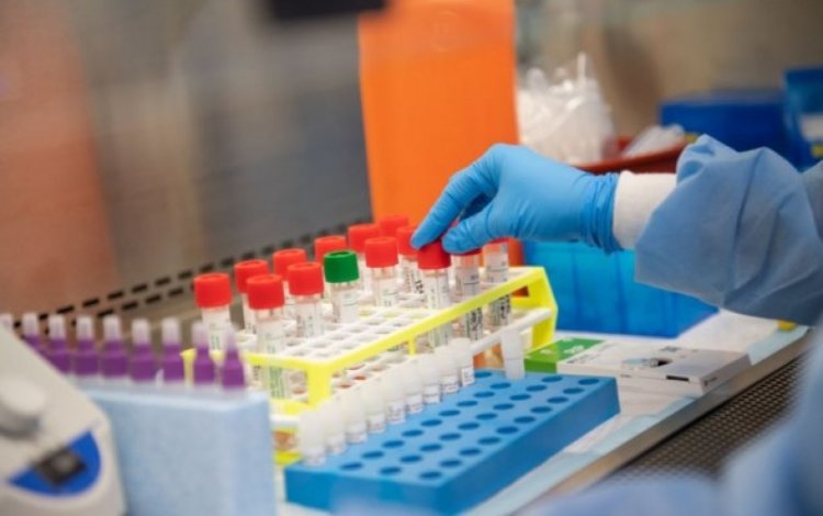Coronavirus, a fine aprile la sperimentazione del vaccino